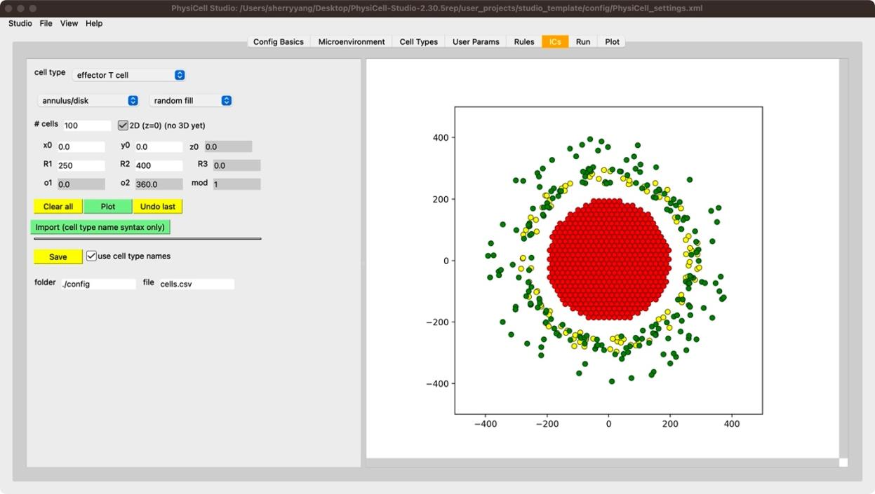 TME: cancer core and immune annulus